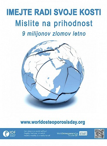 Imejte radi svoje kosti